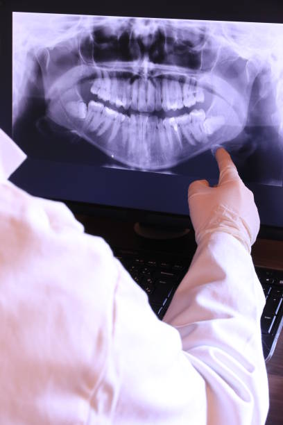 Best Broken or Cracked Tooth Emergency Dentist in Lineville, AL