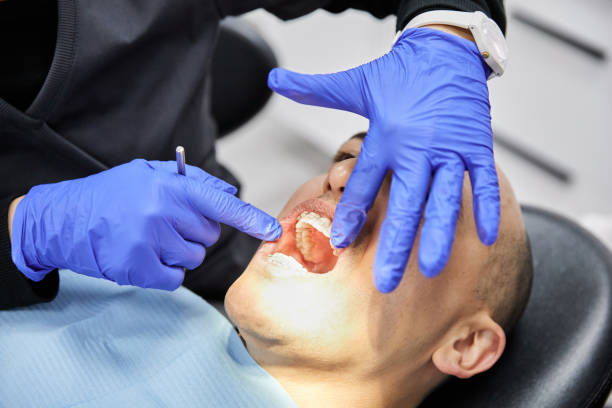 Best Broken or Cracked Tooth Emergency Dentist in Lineville, AL